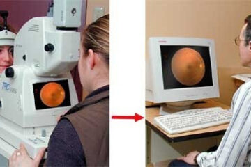 Deux images côte à côte d'examen de la rétine dans un centre de vision