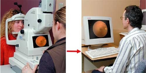 Deux images côte à côte d'examen de la rétine dans un centre de vision